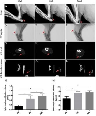 Higher BMP Expression in Tendon Stem/Progenitor Cells Contributes to the Increased Heterotopic Ossification in Achilles Tendon With Aging